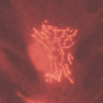 Transfektionsmethoden und deren Optimierung - Übersichts-Kurs